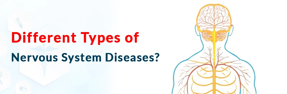 Different Types of Nervous System Diseases?